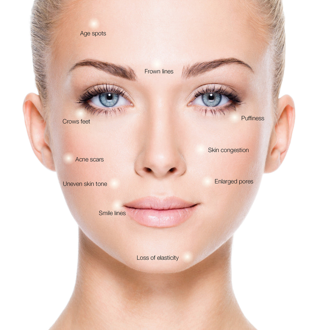 Lordesskin Micro Needling Lift & Renewal Ritual