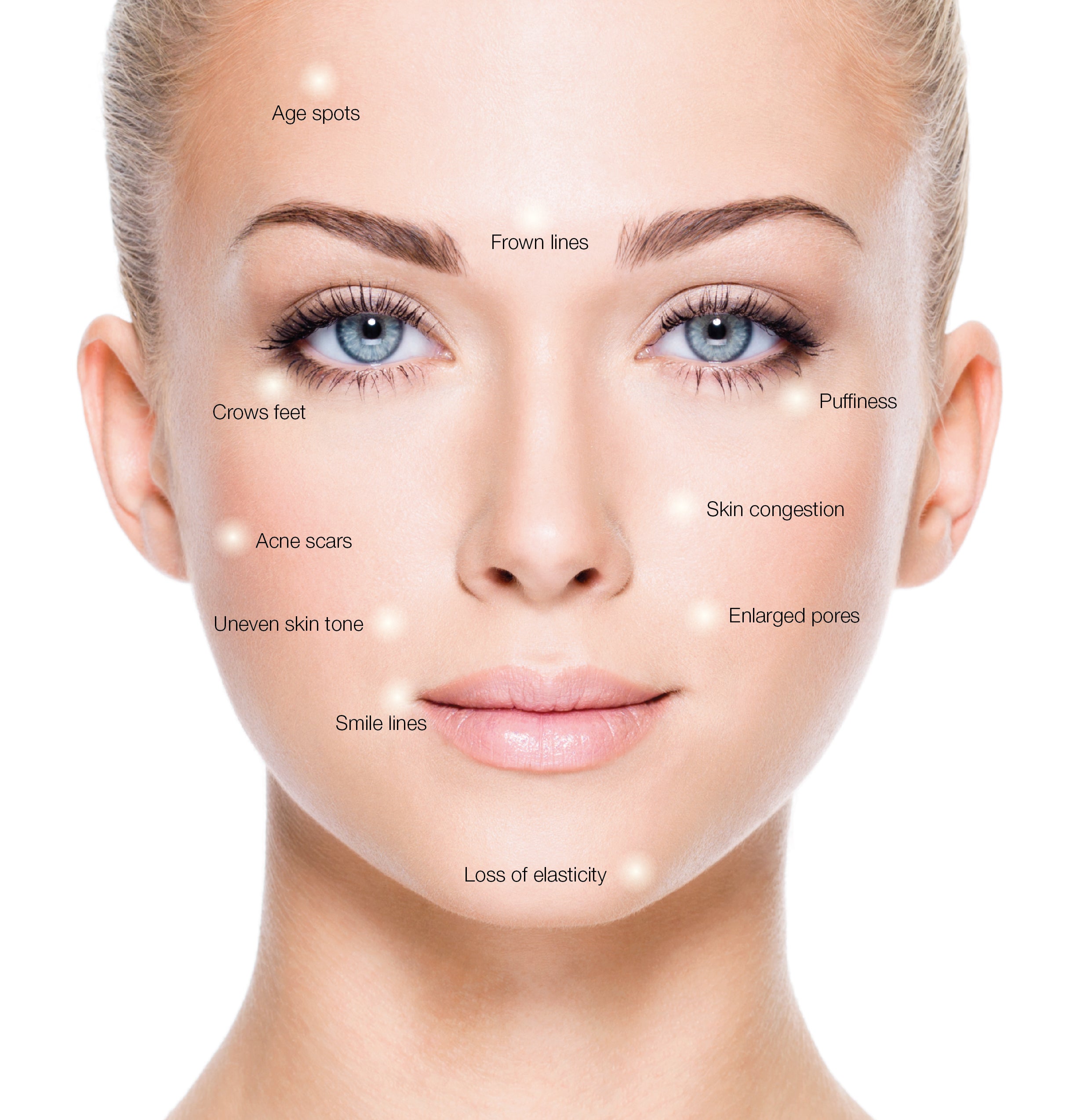 Lordesskin Micro Needling Lift & Renewal Ritual